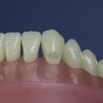 Differentiated Teeth 17