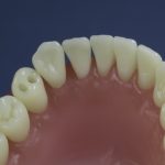 Dentes Diferenciados 16