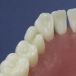 Differentiated Teeth 63