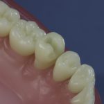 Differentiated Teeth 15