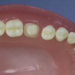 Dentes Diferenciados 49
