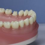 Dentes Diferenciados 183