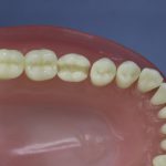 Dentes Diferenciados 48