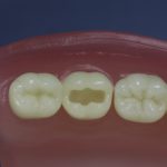 Differentiated Teeth 12