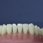 Differentiated Teeth 10