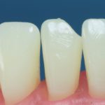 Dentes Diferenciados 9