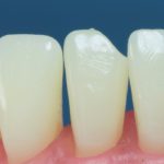 Differentiated Teeth 9