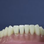 Dentes Diferenciados 8