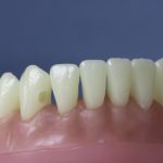 Dentes Diferenciados 7