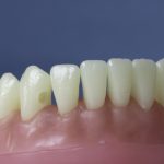 Differentiated Teeth 7