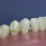 Differentiated Teeth 6