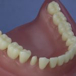 Dentes Diferenciados 44