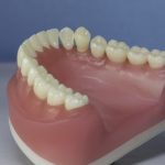 Dentes Diferenciados 179