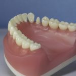Dentes Diferenciados 178