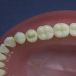 Dentes Diferenciados 5
