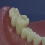 Differentiated Teeth 4