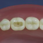 Dentes Diferenciados 3