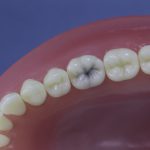Dentes Diferenciados 36