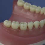 Dentes Diferenciados 40