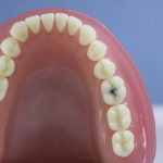 Dentes Diferenciados 153