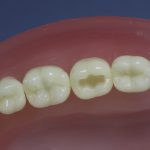 Dentes Diferenciados 1
