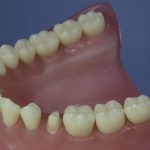 Dentes Diferenciados 53